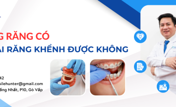 NIỀNG RĂNG CÓ GIỮ LẠI ĐƯỢC RĂNG KHỂNH KHÔNG?