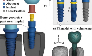  Phân Tích Stress Và Tải Trọng Implant Bằng FEM: Công Nghệ "Nhìn Thấu" Xương Hàm Tại Nha Khoa Smile Hunter
